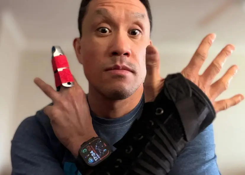 شخصی با ساعت هوشمند و بریس مچ دست، گچ انگشت و چهره‌ای جدی، دستش را بالا نگه داشته است.